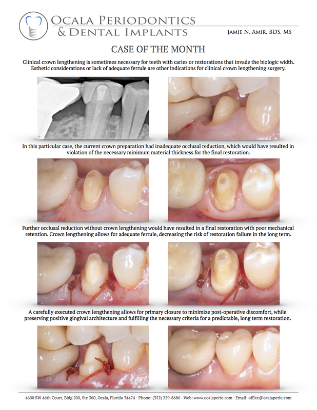 1-case-of-the-month-june-2016_2_orig