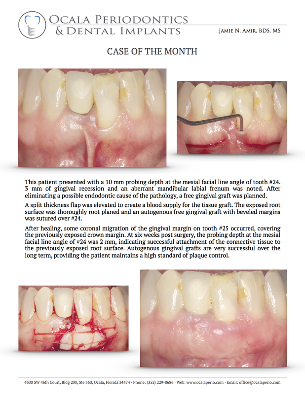 12-case-of-the-month-nov-2013-updated_orig