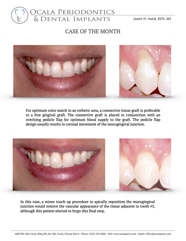 14-case-of-the-month-dec-2013-updated_1_orig