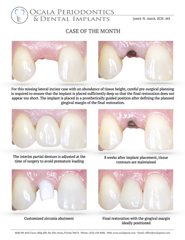 15-case-of-the-month-may-2014-updated_1_orig