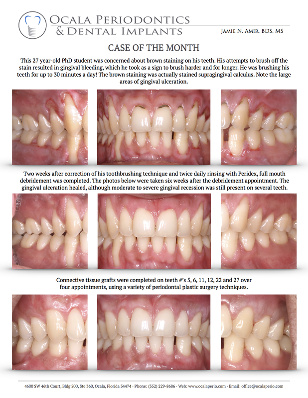 2-case-of-the-month-january-2014-updated_orig