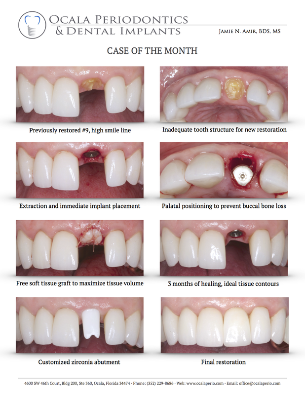 3-case-of-the-month-aug-2015-updated_orig