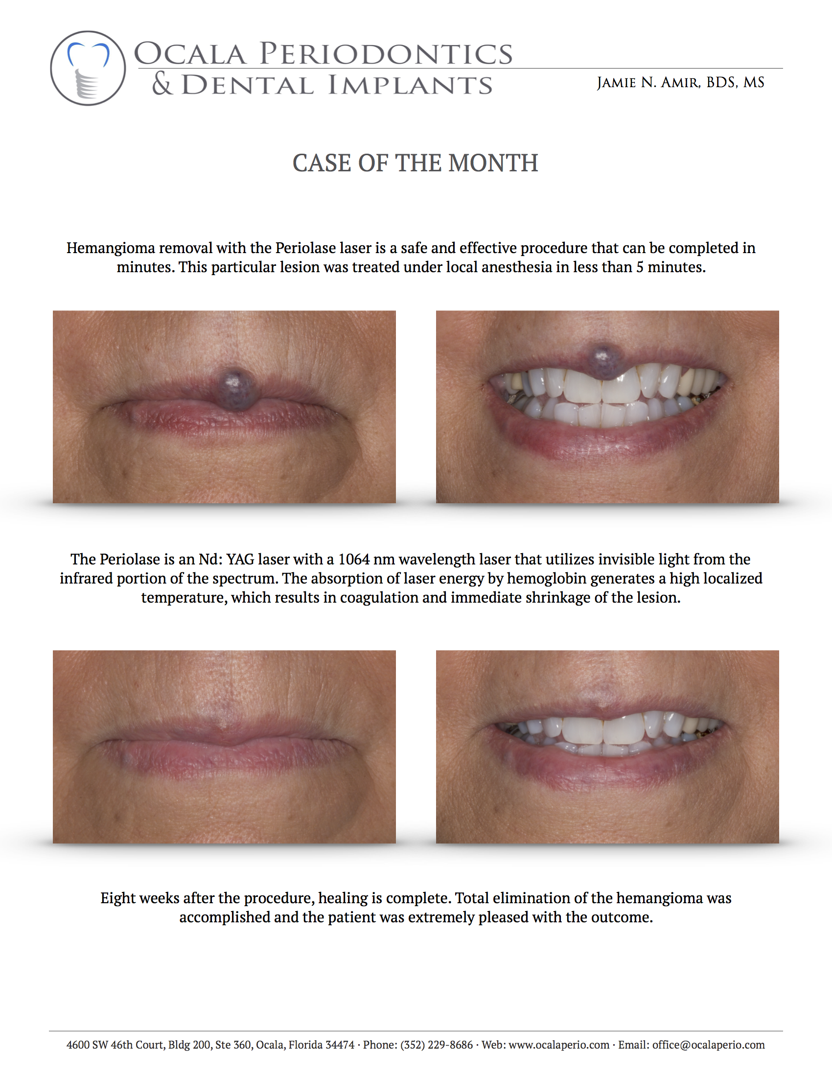 CASE-OF-THE-MONTH-SEP-2017