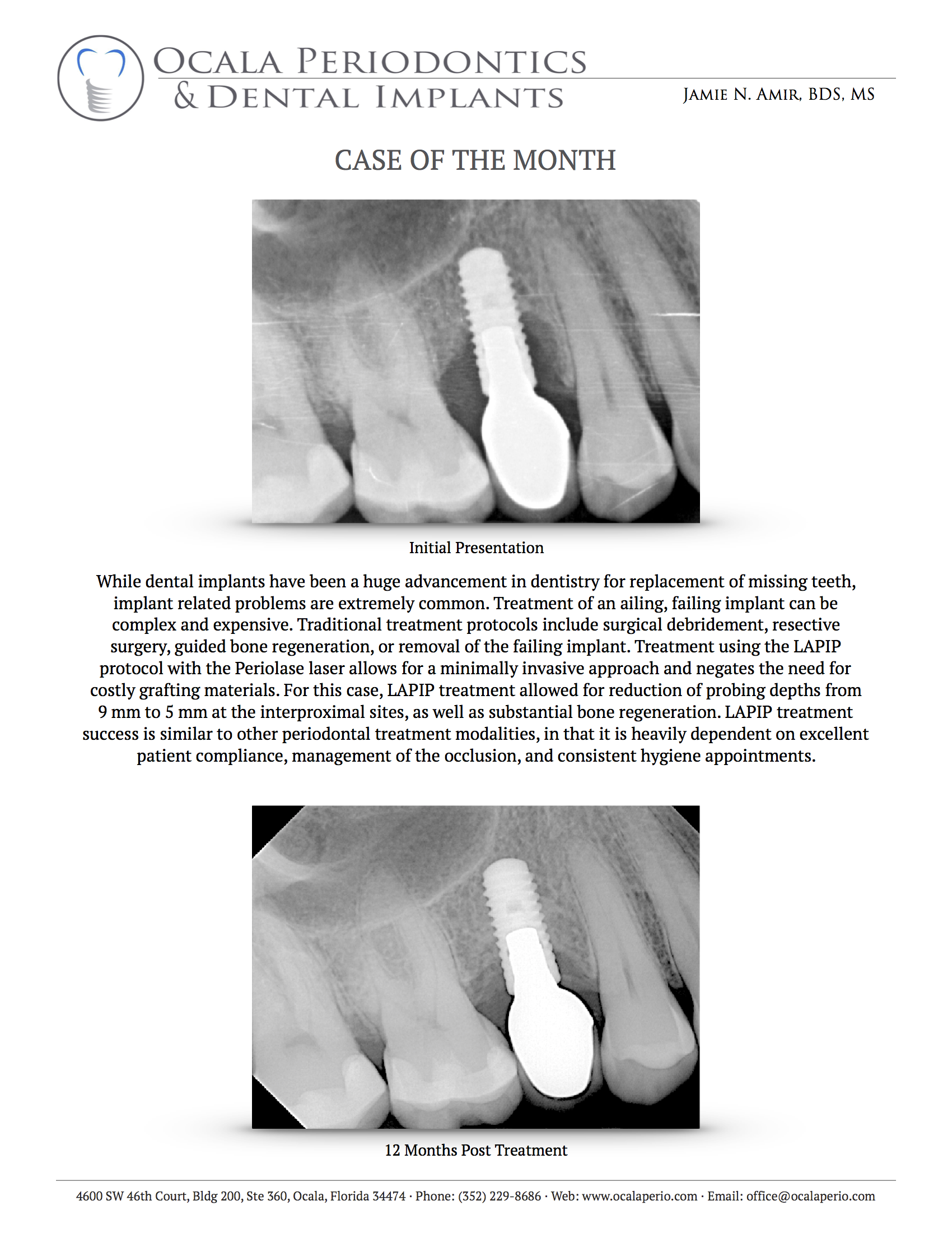 Case-of-the-Month-Dec-2017