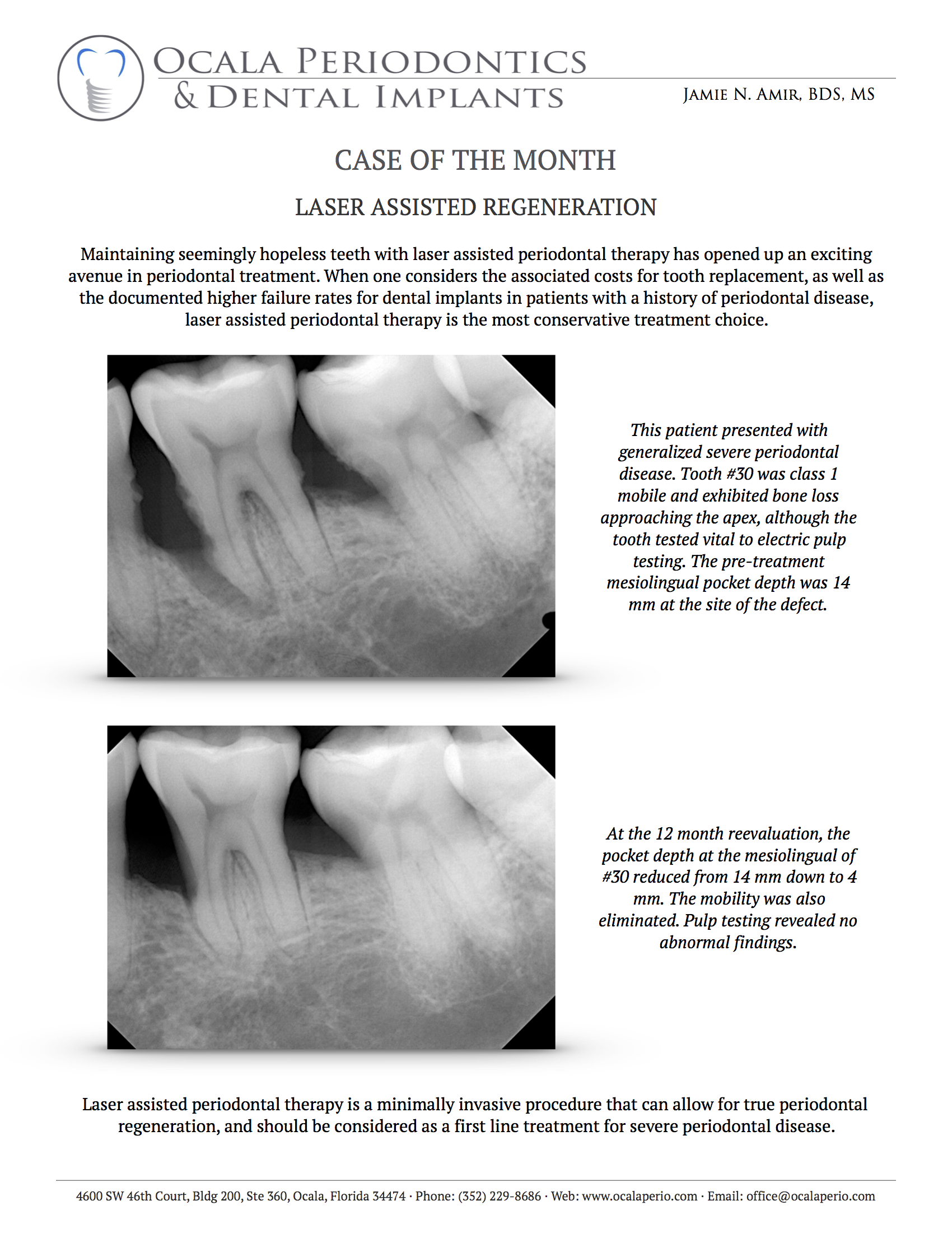Case-of-the-Month-Feb-2018