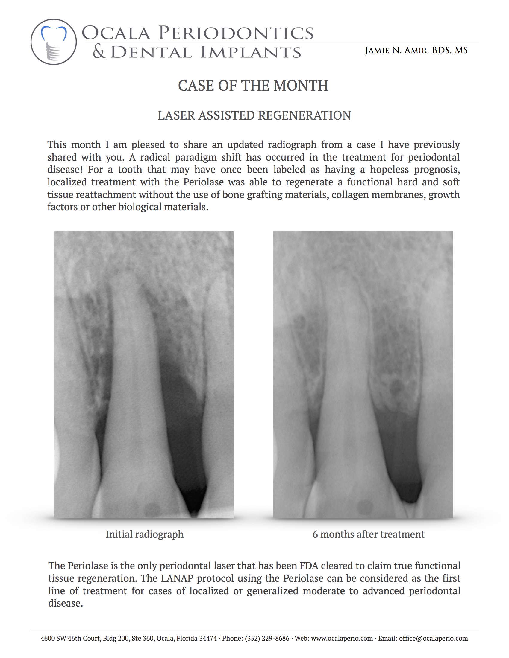 Case-of-the-Month-Sep-2016-v2