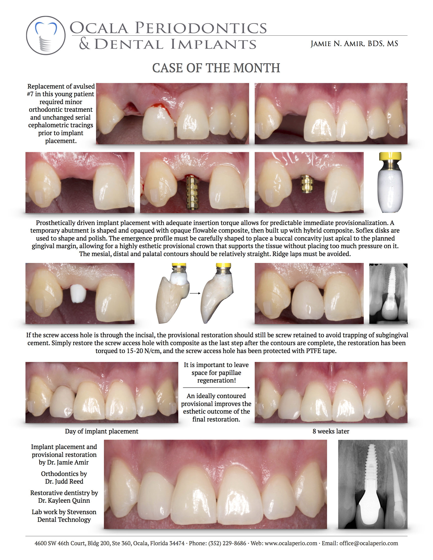 Case-of-the-month-July-2017