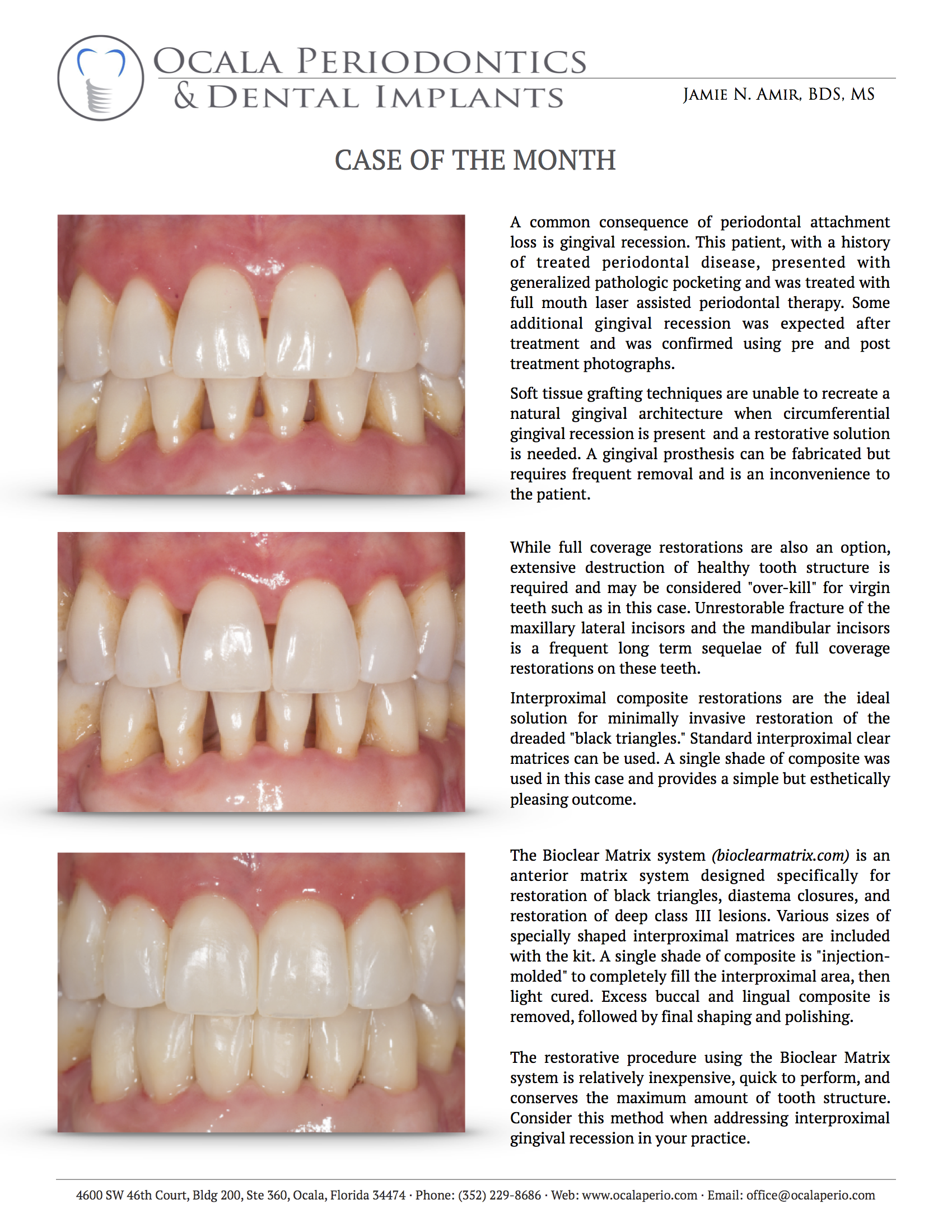 Case-of-the-month-March-2018