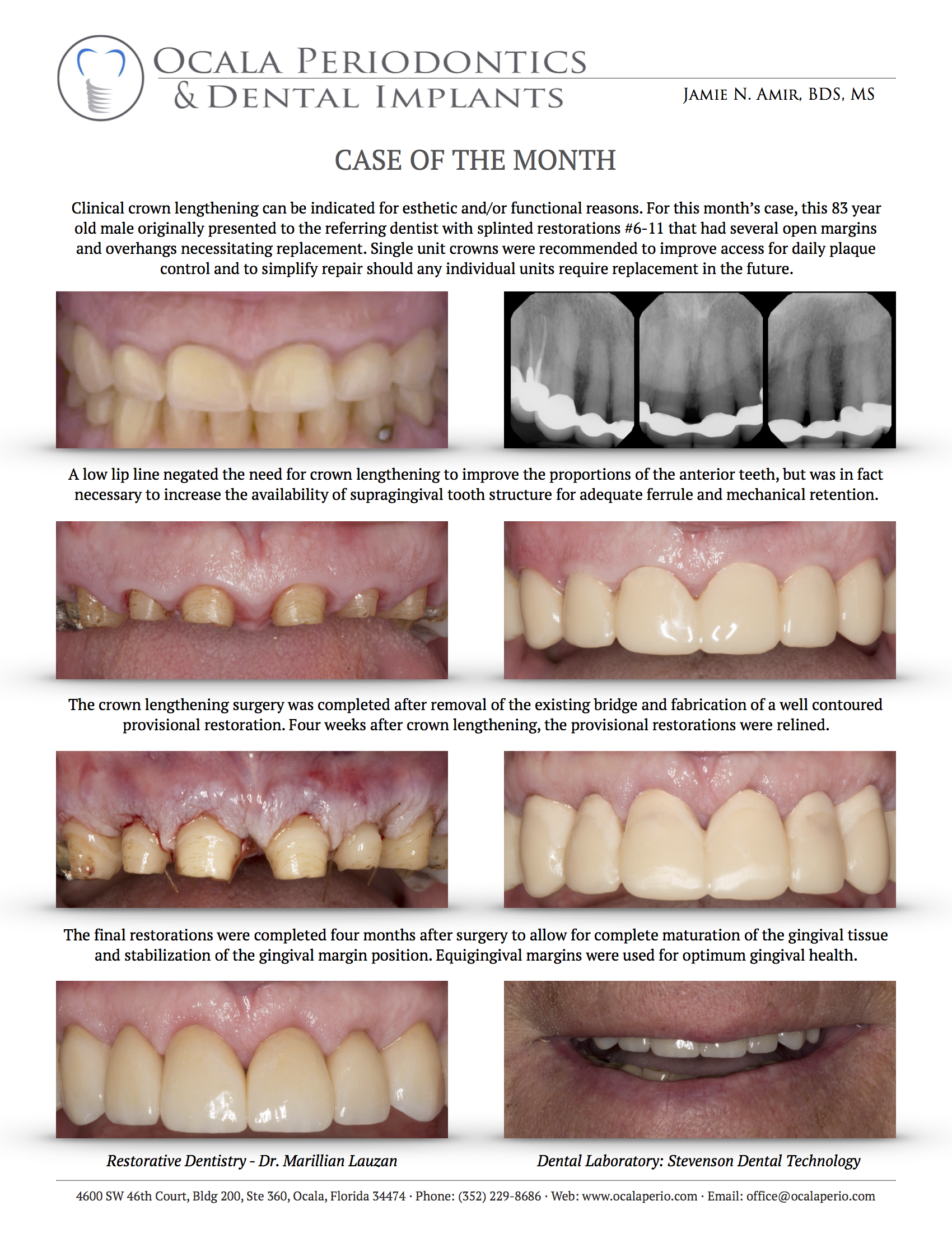 Case-of-the-month-October-2017